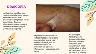 Grupo 2 Lesiones elementales de la piel.pptx