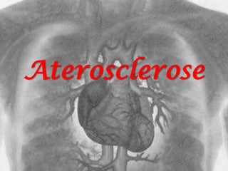 Aterosclerose
 