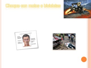 Choque con motos o bicicletas
Unos de los problemas mas serios en el
transito
Vehicular lo constituyen los niños o gente
en
general que conducen este tipo de
estructura ,
Que provoca consecuencias graves.

 