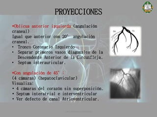 PROYECCIONES
CATETERISMO CARDÍACO
*Oblicua anterior izquierda (angulación
craneal)
Igual que anterior con 20° angulación
craneal.
• Tronco Coronario Izquierdo
• Separar primeros vasos díagonales de la
Descendente Anterior de la Circunfleja.
• Septum interauricular.
*Con angulación de 45°:
(4 cámaras) (hepatoclavicular)
Visualiza:
• 4 cámaras del corazón sin superposición.
• Septum interatrial e interventricular
• Ver defecto de canal Atrioventricular.
 