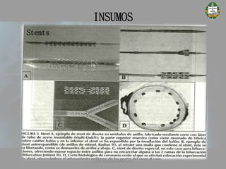 Stents
INSUMOS
CATETERISMO CARDÍACO
 