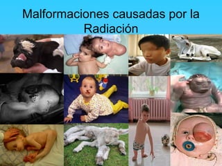 Malformaciones causadas por la 
Radiación 
