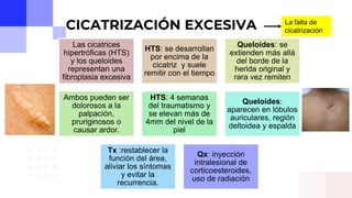 CICATRIZACION DE HERIDAS | PPTX