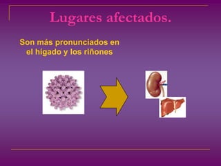 Lugares afectados.Son más pronunciados en el hígado y los riñones