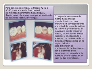 Para penetracion inicial, la fresan #245 o
#556, colocada en la fosa central,
es inclinada ligeramente hacia lingual,
Siguiendo el plano que pasa por el vertice de
las cuspides vestibular y lingua.
En seguida, remuevese la
misma hacia mesial
y hacia distal, con una
profundidad correspondiente
a la mitad de la punta activad
de la Fresa, preservando al
maximo la cresta marginal
mesial, las vertientes de las
cuspides y obedeciendo la
abertura de un cuarto de la
distancia intercuspidea en la
region del istmo.
Esta dimension es
practicamente de terminada
por el diametro de la
fresa, que corresponde a la
abertura de un cuarto en el
caso de los premolares.
 