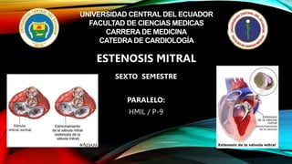 UNIVERSIDAD CENTRAL DEL ECUADOR
FACULTAD DE CIENCIAS MEDICAS
CARRERA DE MEDICINA
CATEDRA DE CARDIOLOGÍA
SEXTO SEMESTRE
PARALELO:
HMIL / P-9
ESTENOSIS MITRAL
 