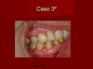 Caso 3º




Jesús Jover
 