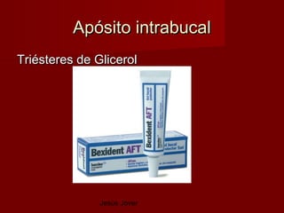Apósito intrabucal
Triésteres de Glicerol




               Jesús Jover
 