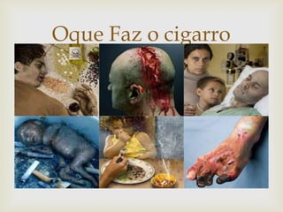 Oque Faz o cigarro


 