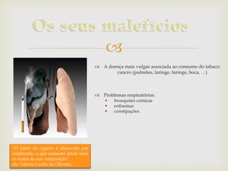 
 A doença mais vulgar associada ao consumo do tabaco:
cancro (pulmões, laringe, faringe, boca, …)

 Problemas respiratórios:




“O fumo do cigarro é absorvida por
combustão, o que aumenta ainda mais
os males da sua composição",
diz Valéria Cunha de Oliveira,

bronquites crónicas
enfisemas
constipações.

 