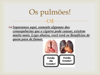 Os pulmões!

 Separamos aqui, somente algumas das
consequências que o cigarro pode causar, existem
muito mais. Logo abaixo, você verá os Benefícios de
quem para de fumar.

 