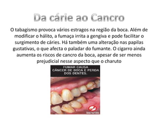 O tabagismo provoca vários estragos na região da boca. Além de
modificar o hálito, a fumaça irrita a gengiva e pode facilitar o
surgimento de cáries. Há também uma alteração nas papilas
gustativas, o que afecta o paladar do fumante. O cigarro ainda
aumenta os riscos de cancro da boca, apesar de ser menos
prejudicial nesse aspecto que o charuto

 