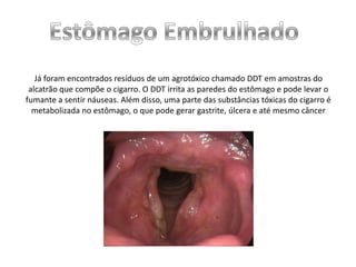 Já foram encontrados resíduos de um agrotóxico chamado DDT em amostras do
alcatrão que compõe o cigarro. O DDT irrita as paredes do estômago e pode levar o
fumante a sentir náuseas. Além disso, uma parte das substâncias tóxicas do cigarro é
metabolizada no estômago, o que pode gerar gastrite, úlcera e até mesmo câncer

 