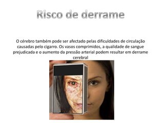 O cérebro também pode ser afectado pelas dificuldades de circulação
causadas pelo cigarro. Os vasos comprimidos, a qualidade de sangue
prejudicada e o aumento da pressão arterial podem resultar em derrame
cerebral

 