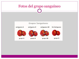 Fotos del grupo sanguíneo
 