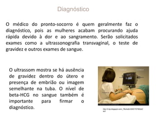 Diagnóstico
O médico do pronto-socorro é quem geralmente faz o
diagnóstico, pois as mulheres acabam procurando ajuda
rápida devido à dor e ao sangramento. Serão solicitados
exames como a ultrassonografia transvaginal, o teste de
gravidez e outros exames de sangue.
http://3.bp.blogspot.com/_76s3u6cV2KE/TDT9DzkZ
wuI
O ultrassom mostra se há ausência
de gravidez dentro do útero e
presença de embrião ou imagem
semelhante na tuba. O nível de
beta-HCG no sangue também é
importante para firmar o
diagnóstico.
 