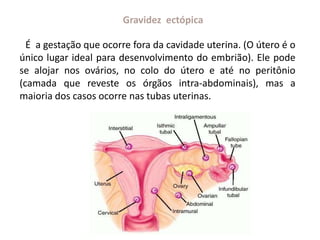 É a gestação que ocorre fora da cavidade uterina. (O útero é o
único lugar ideal para desenvolvimento do embrião). Ele pode
se alojar nos ovários, no colo do útero e até no peritônio
(camada que reveste os órgãos intra-abdominais), mas a
maioria dos casos ocorre nas tubas uterinas.
Gravidez ectópica
 