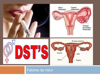 Fatores de risco
 