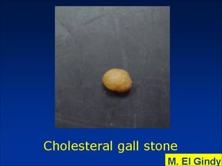 General surgery instruments