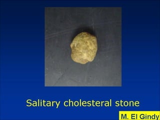 General surgery instruments