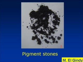 General surgery instruments