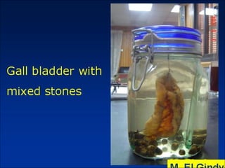 General surgery instruments