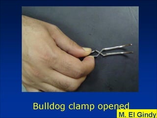 General surgery instruments