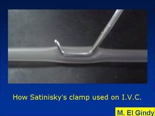 General surgery instruments