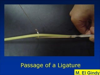 General surgery instruments