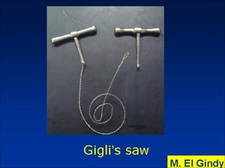 General surgery instruments