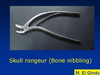 General surgery instruments