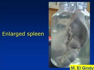 General surgery instruments