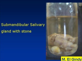 General surgery instruments