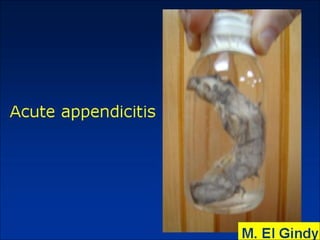 General surgery instruments