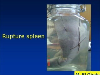 General surgery instruments