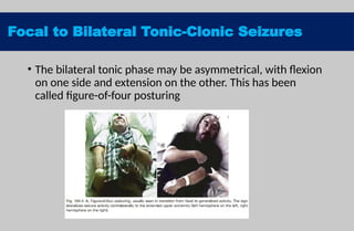 Seizure disorderin children new updated.pptx