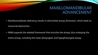 MAXILLOMANDIBULAR
ADVANCEMENT
• Maxillomandibular deficiency results in diminished airway dimension, which leads to
nocturnal obstruction.
• MMA expands the skeletal framework that encircles the airway, thus enlarging the
entire airway, including the nasal, pharyngeal, and hypopharyngeal airway.
 