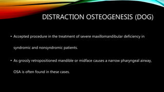 DISTRACTION OSTEOGENESIS (DOG)
• Accepted procedure in the treatment of severe maxillomandibular deficiency in
syndromic and nonsyndromic patients.
• As grossly retropositioned mandible or midface causes a narrow pharyngeal airway,
OSA is often found in these cases.
 