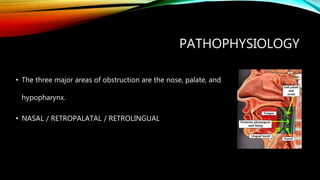 PATHOPHYSIOLOGY
• The three major areas of obstruction are the nose, palate, and
hypopharynx.
• NASAL / RETROPALATAL / RETROLINGUAL
 