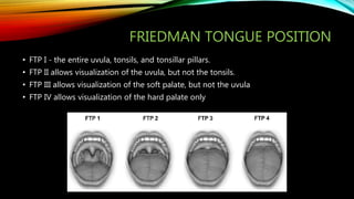 FRIEDMAN TONGUE POSITION
• FTP I - the entire uvula, tonsils, and tonsillar pillars.
• FTP II allows visualization of the uvula, but not the tonsils.
• FTP III allows visualization of the soft palate, but not the uvula
• FTP IV allows visualization of the hard palate only
 