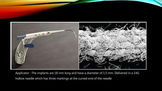 Applicator : The implants are 18 mm long and have a diameter of 1.5 mm. Delivered in a 14G
hollow needle which has three markings at the curved end of the needle
 