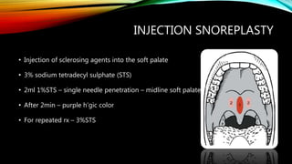 INJECTION SNOREPLASTY
• Injection of sclerosing agents into the soft palate
• 3% sodium tetradecyl sulphate (STS)
• 2ml 1%STS – single needle penetration – midline soft palate
• After 2min – purple h’gic color
• For repeated rx – 3%STS
 