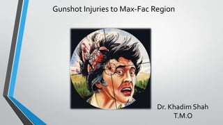 Gunshot Injuries to Max-Fac Region
Dr. Khadim Shah
T.M.O
 