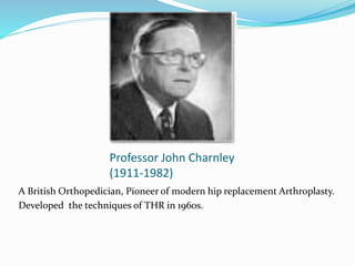 Professor John Charnley
(1911-1982)
A British Orthopedician, Pioneer of modern hip replacement Arthroplasty.
Developed the techniques of THR in 1960s.
 