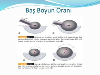 Baş Boyun Oranı
 