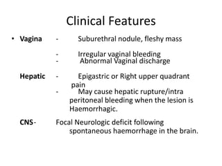 Clinical Features
• Vagina

Suburethral nodule, fleshy mass

Hepatic

-

Irregular vaginal bleeding
Abnormal Vaginal discharge

-

-

CNS-

Epigastric or Right upper quadrant
pain
May cause hepatic rupture/intra
peritoneal bleeding when the lesion is
Haemorrhagic.

Focal Neurologic deficit following
spontaneous haemorrhage in the brain.

 