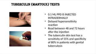 G TB NEW, ppt by dr maney[Autosaved].pptx
