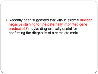  Recently been suggested that villous stromal nuclear
 negative staining for the paternally imprinted gene
 product p57 maybe diagnostically useful for
 confirming the diagnosis of a complete mole
 