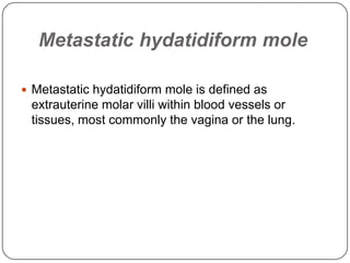 Metastatic hydatidiform mole

 Metastatic hydatidiform mole is defined as
 extrauterine molar villi within blood vessels or
 tissues, most commonly the vagina or the lung.
 