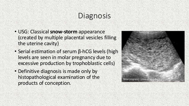 Gestational trophoblastic diseases A review for PG preparation